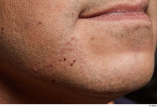 HD Face Skin Gabriel Ros cheek chin face lips mouth…